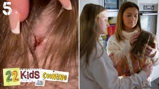 Heidie Had An Accident  | 22 Kids And Counting