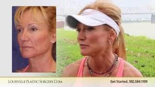 Mini Facelift   Tawnia   Recovery Timeline