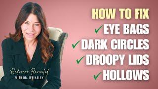 The Dermatologist’s Guide to Eye Bags, Dark Circles, Droopy Lids & Hollows