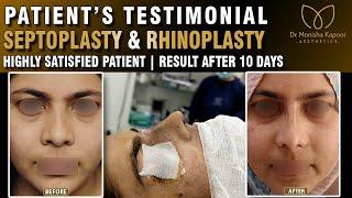 Desire Rhinoplasty Surgery | Nose Like Katrina Kaif | Nose Surgery Before & After |Dr Monisha Kapoor