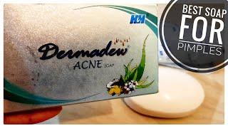 Best Soap For Acne | Dermadew Acne Soap Review | फायदे और नुकसान | Demo |पूरी जानकारी |Shruti Mishra