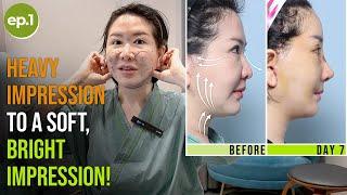 Strong and Heavy Impression to a Soft, Bright Impression through Multiple Surgeries! | Forehead Lift