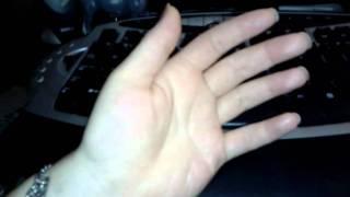 Fibromyalgia symptom - Twitchy Fingers