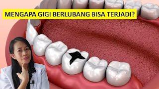 Mengapa gigi berlubang bisa terjadi ?