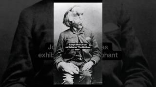 The sad story of Joseph Merrick, The Elephant Man #history #art #painting