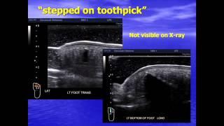 Pediatric Applications of Toshiba Ultrasound, Dr. Sally O'Hara