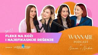 WANNABE podcast sa Ninom i Nađom ep.12: Fleke na koži i najefikasnije rešenje