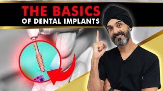 Dental Implants 101 - What you need to know