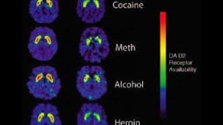 Mind Altering Substances: How Drugs Affect the Brain