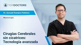 Cirugías Cerebrales sin cicatrices: Tecnología avanzada