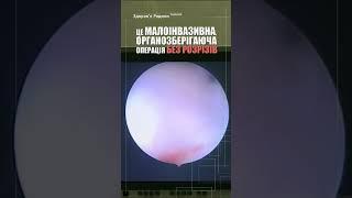 Гістероскопiчний метод видалення міоми. Малоінвазивна, органозберігаюча операція без розрізів.