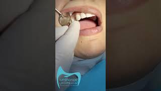 You Deserve a Healthy Smile. #short #short #shortvideo #shortsvideo #dubai