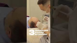 Остановить выпадение волос? Легко!  #косметолог #красотаназдоровье #прп #prp