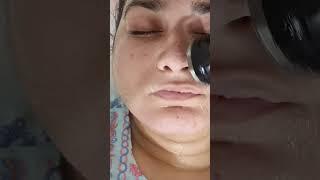 Radiofrequency Skin Tightening Facial Face Lift Neck Lift  #Skincare #shorts #skintransformation