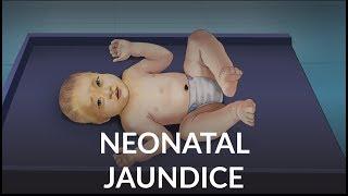 Neonatal Jaundice by L. Veit | OPENPediatrics