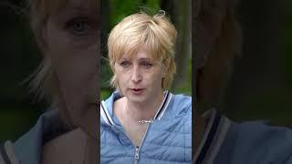 Шрамы от ожогов #shorts