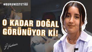 Burun Ameliyatı Olduğuma İnanmıyorlar! Burun Ameliyatı Op. Dr. Güray Yeşiladalı