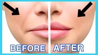 Smile Lines Facial Exercises & Massage  (Nasolabial Folds/ Laugh Lines)