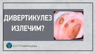 ДИВЕРТИКУЛЕЗ можно ли вылечить?