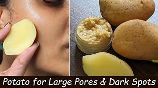 i used Potato Face Pack daily to Remove DARK Spots - Close Large Open Pores & Skin Whitening