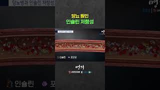 인슐린 저항성 한번에 이해하기️