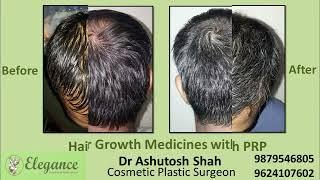 PRP Hair Thearpy, Hair Loss Treatment, Permanent Solutation For Hair Loss, Surat, Bharuch, Kosabam.