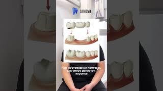 Для чего искусственные коронки  #доктор #дети #коронкиназубы #зубы #лечение #стоматология