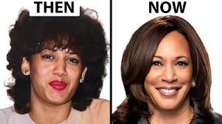 Kamala Harris NEW FACE | Plastic Surgery Analysis