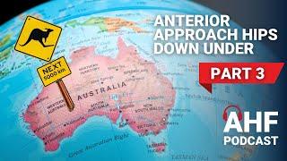 Part III: Examining Anterior Approach from Down Under