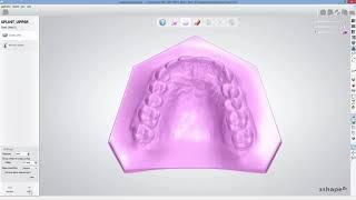 3DBioCAD - 3Shape Dental System Splint Design