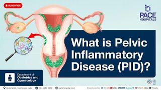 What is PID Disease? | What is Pelvic Inflammatory Disease ? | #short  #viral #PID #piddisease