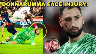 Donnarumma Horrific Face Injury During PSG 4-2 v AS Monaco