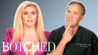 REJECTED by Botched: Sammi's Paying The Price Of Following The Trends | Botched | E!