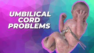 Three common umbilical cord problems in newborns...and when to worry