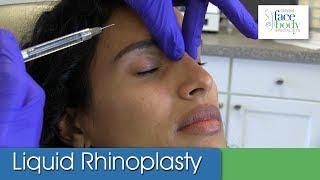 Dr. Clevens | Am I a candidate for Clevens Instant Liquid Rhinoplasty?