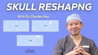 SKULL RESHAPING with Dr. Charles Hsu - Line Plastic Surgery Center Los Angeles/ 두상성형 인터뷰/ 头骨整形 洛杉矶