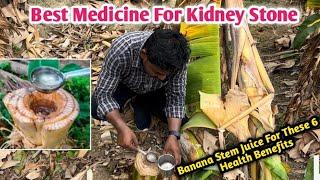 Banana Stem Juice | Best Medicine for Kidney Stone | Drink Banana Stem Juice For  6 Health Benefits