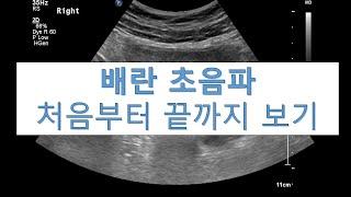 배란 초음파 처음부터 끝까지 보기 l 모두 임신준비 화이팅 