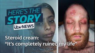 Steroid cream: "It's completely ruined my life | ITV News