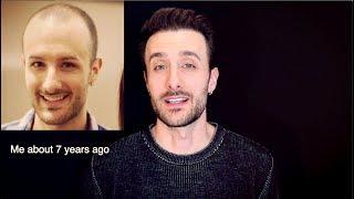 No More Hair Transplant Videos!