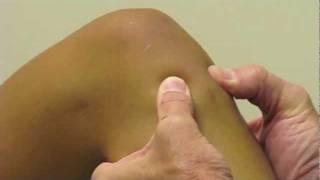 ACL Exam Lachman's Test, Pivot Shift, Drawer Test performed by Dr. Eric Janssen