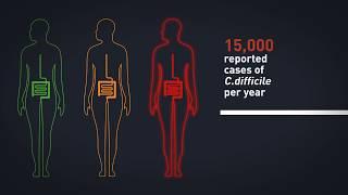 Faecal Microbiota Transplants (FMT) for treatment of serious infection