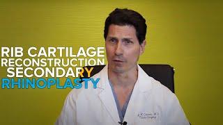 Dr. Jay Calvert explains Rib Cartilage Reconstruction Secondary Rhinoplasty