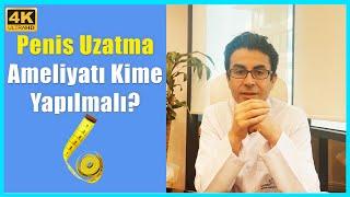 #Penis #Uzatma  Ameliyatı Kime Yapılmalı?  Doç. Dr. Muhsin Balaban