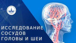  Показания для исследования сосудов головы и шеи. Исследование сосудов головы и шеи. МНОЦ МГУ. 18+