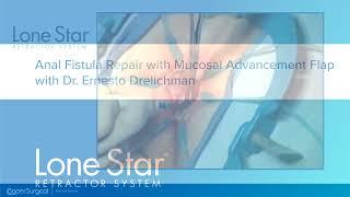 Anal Fistula Repair With Mucosal Advancement Flap Using Lone Star
