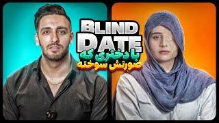 Blind Date با دختری که صورتش سوخته
