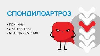 Спондилоартроз