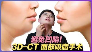 想吸脂，怕凹陷？了解一下3D-CT面部吸脂手术吧！ (feat:李朴频道LpChannel)