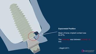 Crestal vs  Subcrestal position Neodent